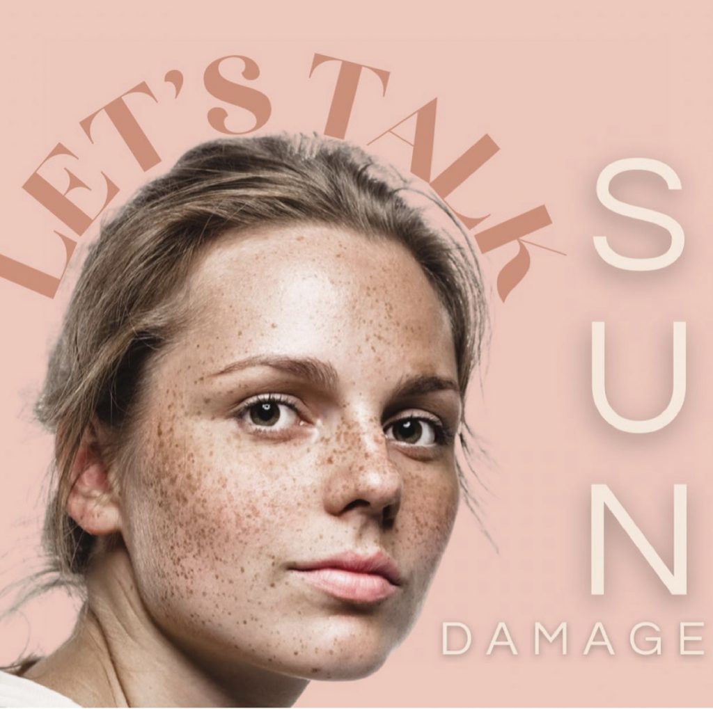 Avoid tanning with Sun Damage